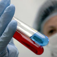 Медики не прогнозируют повторной эпидемии свиного гриппа в Украине, однако предупреждают о новом штамме вируса