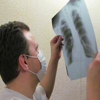 19-28 марта в Киеве можно будет бесплатно обследоваться на туберкулез