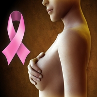 Рак молочной железы: профилактика и борьба